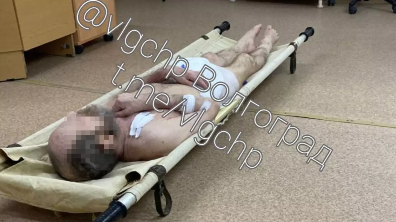 Пациента после реанимации бросили замерзать в коридоре больницы под Волгоградом